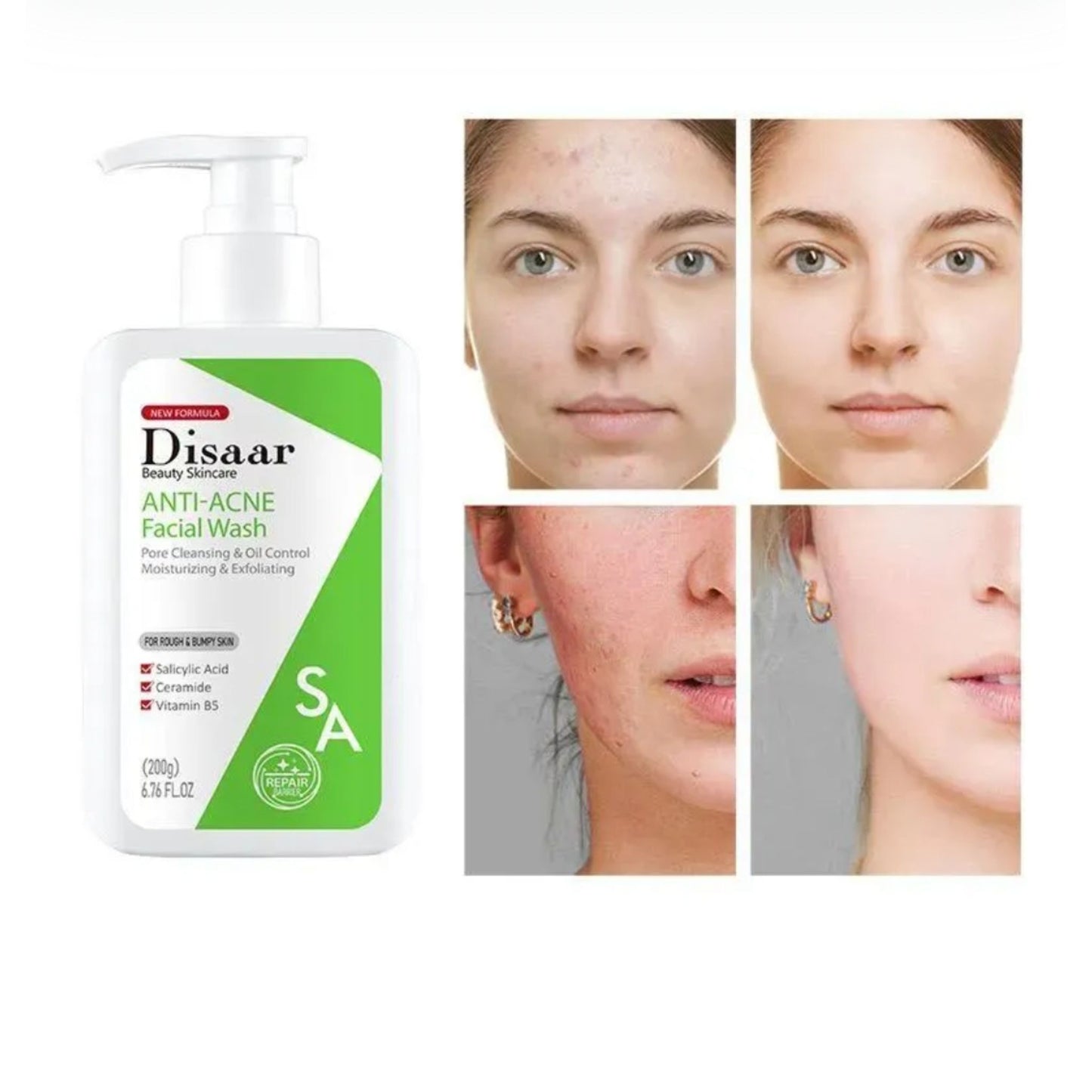 Jabón Facial Anti Acné Disaar DS5320